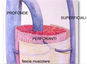 Le recidive dopo intervento alla sadfena possono essere connesse alle vene perforanti